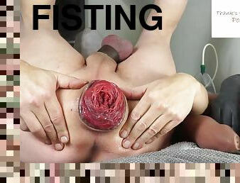 My latest &amp; nicest Proplase Vid - rough anal fist my horny rosebud 